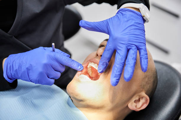 Best Emergency Care for Gum Disease in Good Hope, CA